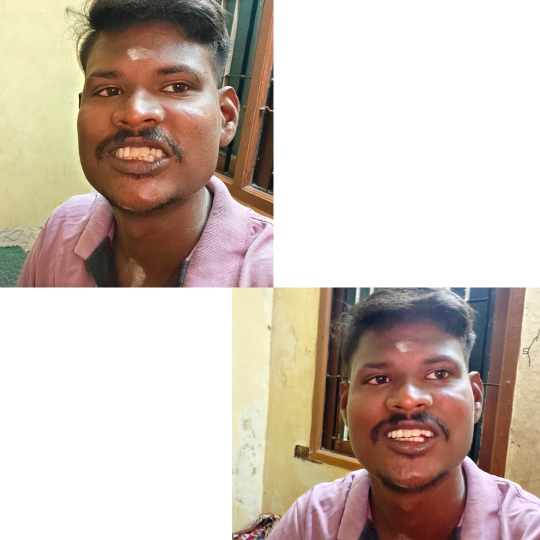 _Best pediatric dentist in Valasaravakkam (5)