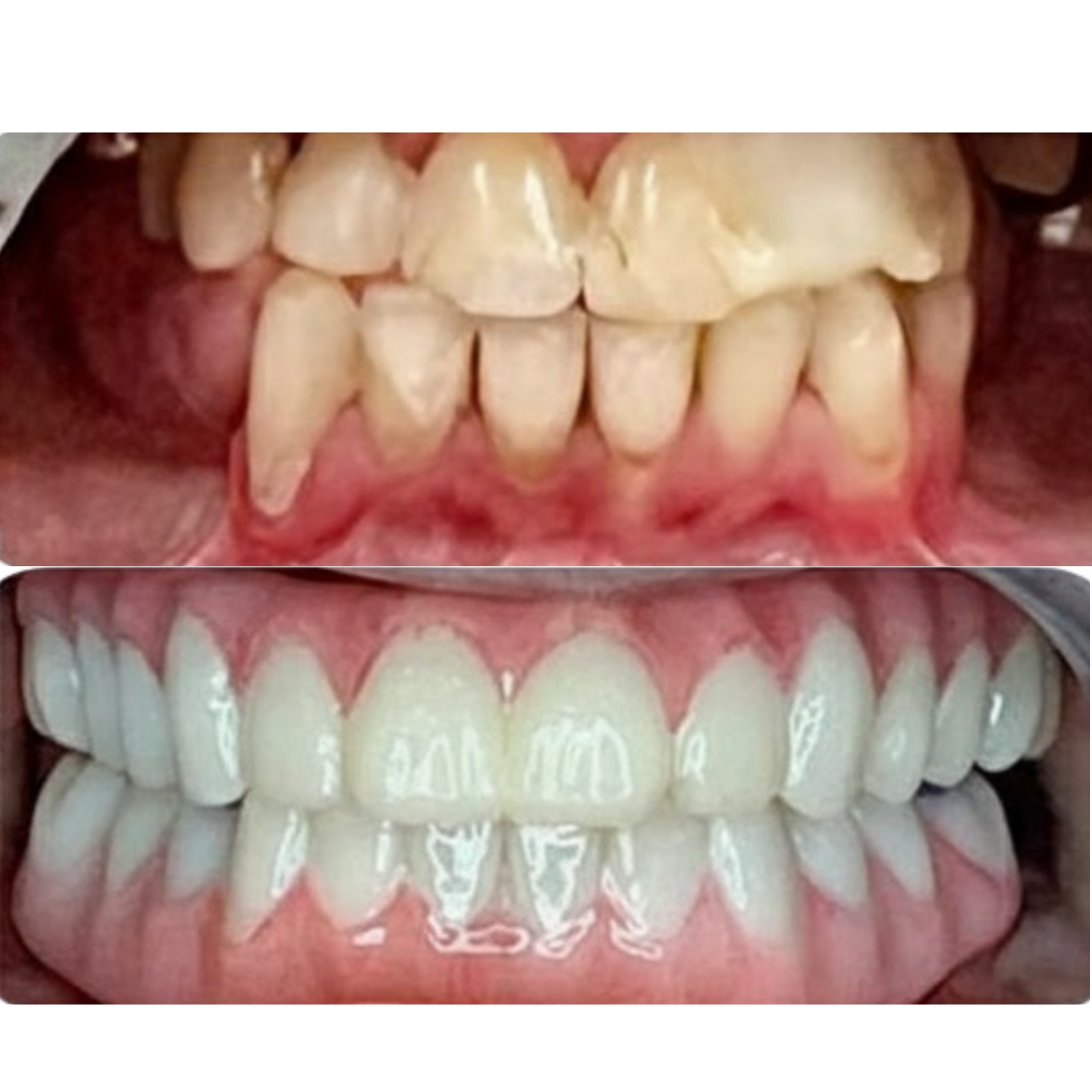 _Best pediatric dentist in Valasaravakkam (7)